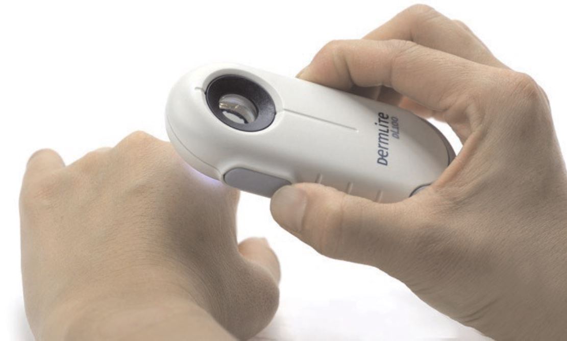 Dermatoskop DermLite 100